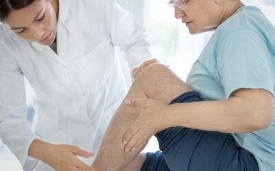 Eczema varicoso: causas, sintomas, tratamento e prevenção