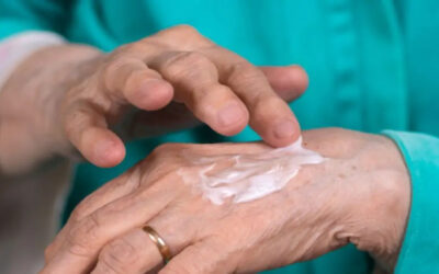Eczema asteatótica: o que é, causas, sintomas e tratamento
