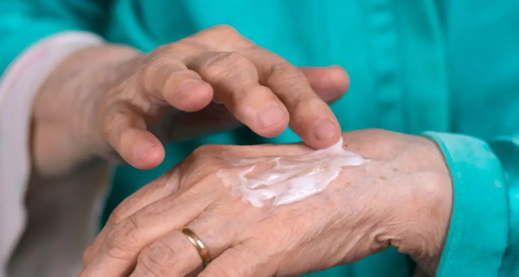 Eczema asteatótica: o que é, causas, sintomas e tratamento