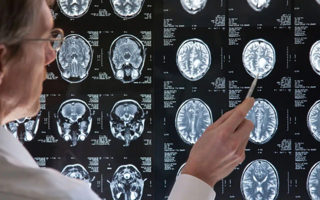 Gestação sob morte cerebral: o caso de Adriana Smith e o debate entre medicina, ética e legislação