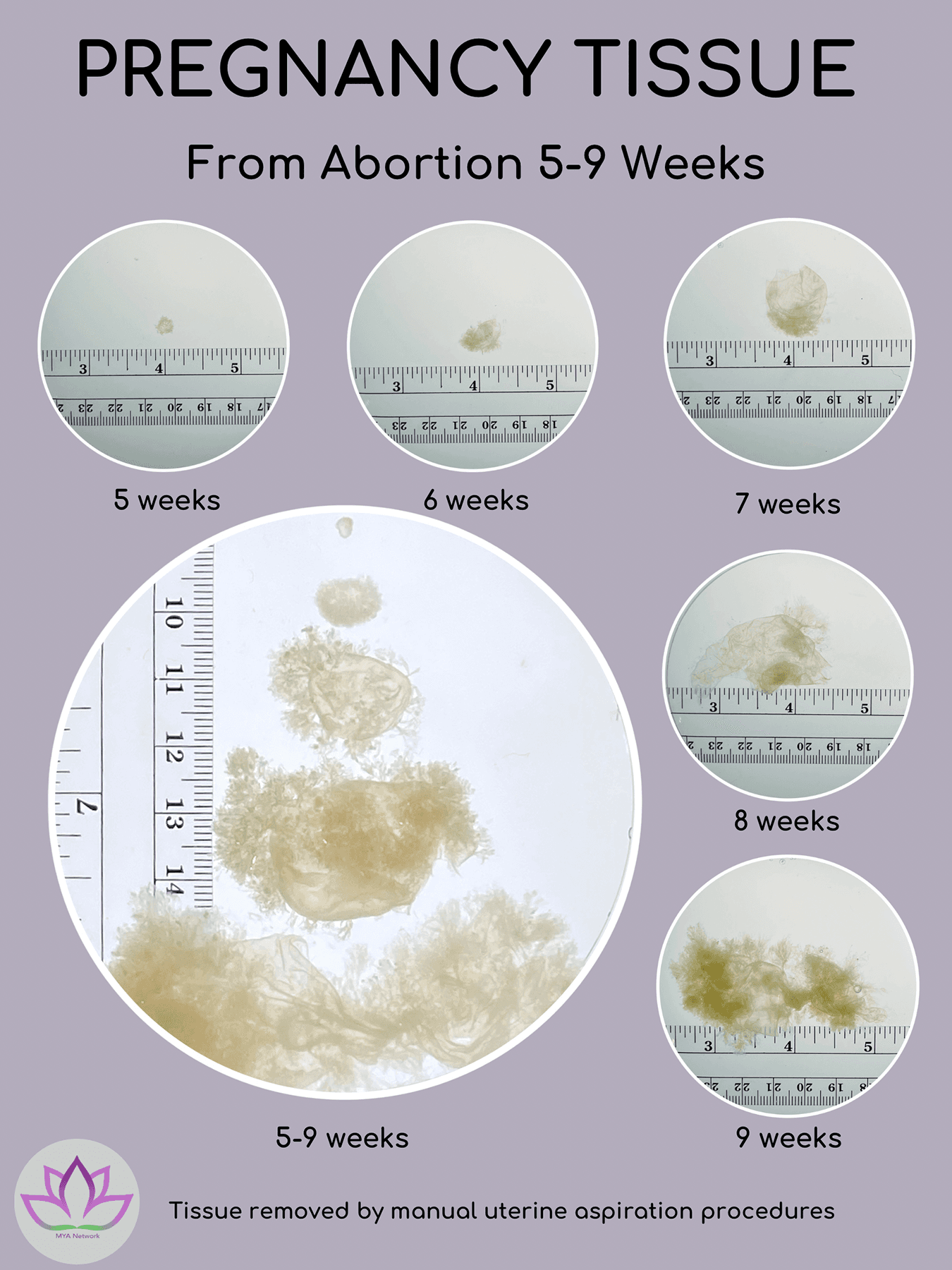 pregnancy tissue