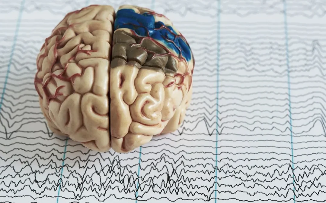 Epilepsy: Causes, Types of Seizures, Treatment, Myths, and Facts