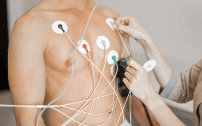 Fibrilação atrial: o que é, sintomas, causas e tratamento da arritmia mais comum do mundo