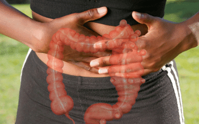 Diverticulite: sintomas, causas, diagnóstico e tratamento