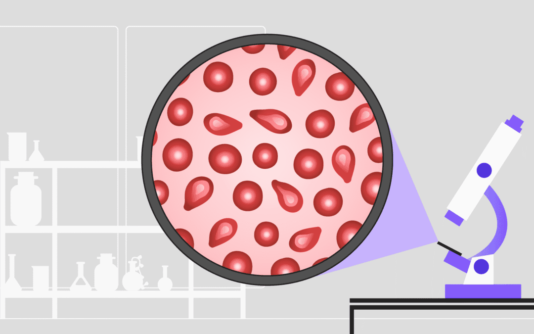 Talassemia: tipos, sintomas, diagnóstico, tratamento e controle de ferro
