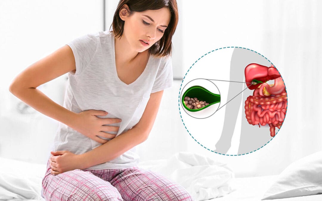 Colelitíase (pedra na vesícula): sintomas, diagnóstico, tratamento, complicações e prevenção