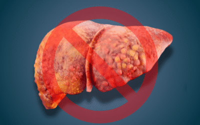 Cirrose hepática: causas, sintomas, diagnóstico, complicações, tratamento e prevenção