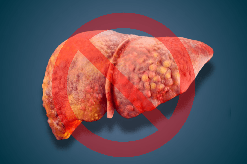 Cirrose hepática: causas, sintomas, diagnóstico, complicações, tratamento e prevenção