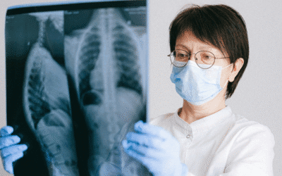 Dia Mundial de Combate à Tuberculose : (24 de março) sintomas, transmissão, diagnóstico, tratamento e como prevenir