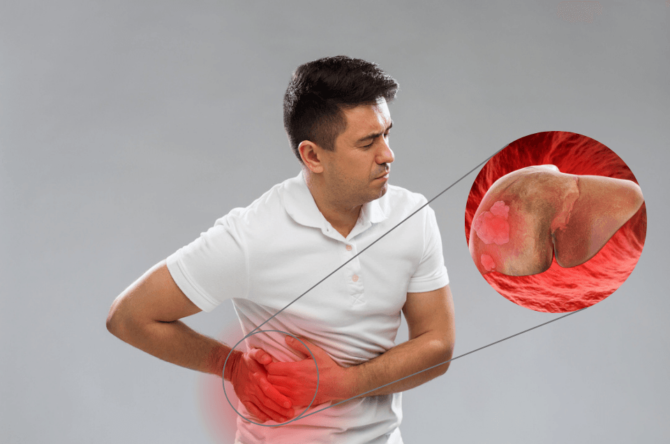 Liver Cancer: symptoms, risk factors, diagnosis, treatment, and prognosis