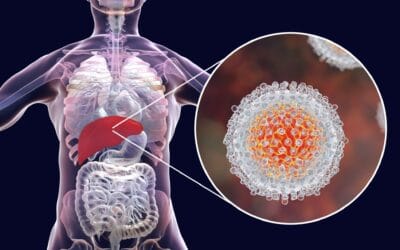 Hepatite C: transmissão, sintomas, diagnóstico, tratamento e possibilidade de cura