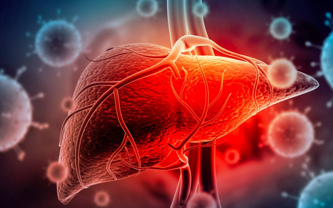 Hepatite E: transmissão por água e alimentos, riscos na gravidez, diagnóstico e prevenção